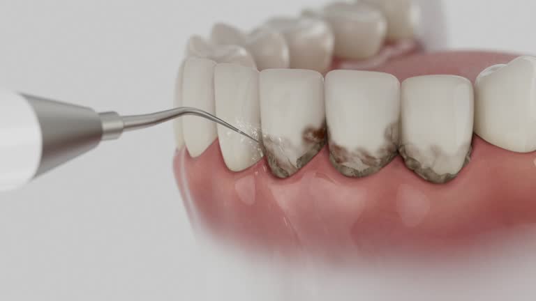Trusted Invisalign Clear Aligners service in Huron, OH - Dentist Open Now